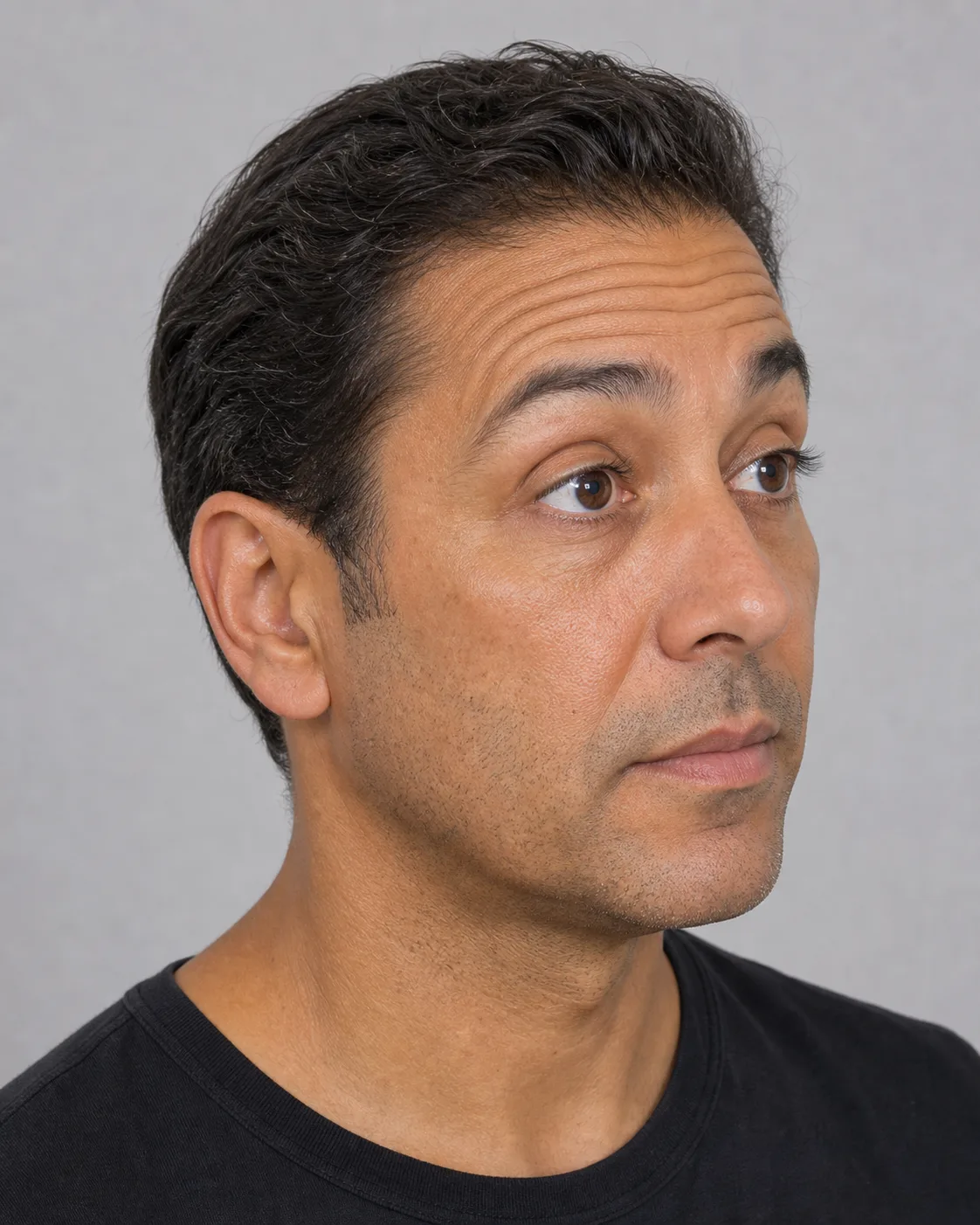 Three quarter upper-face portrait for general forehead assessment information at Core Aesthetics in Oakleigh
