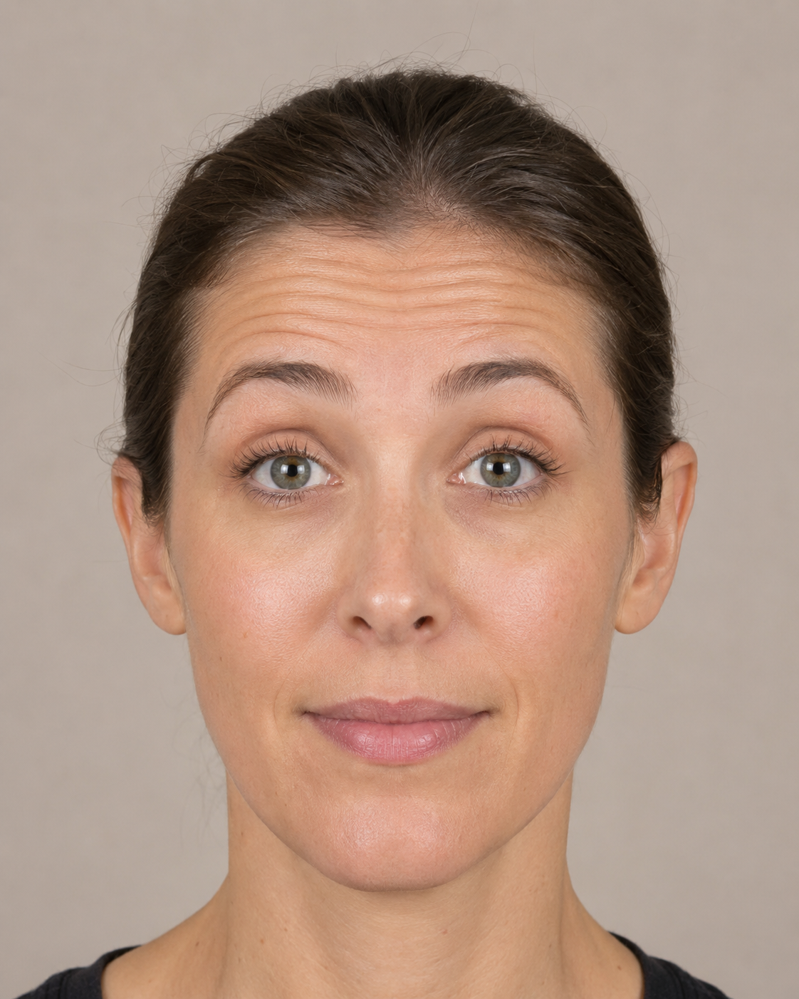 Wrinkle and upper-face consultation assessment for consultation planning at Core Aesthetics in Oakleigh