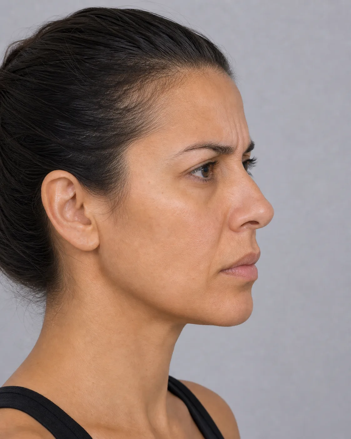 Side upper face view for a Brighton East wrinkle consultation recording leave alone boundaries