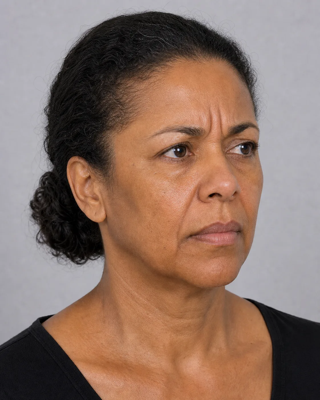 Three quarter forehead and brow portrait shown for general information at Core Aesthetics in Oakleigh