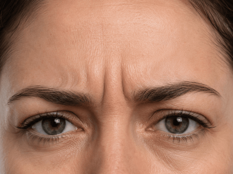 Adult upper-face view during a frown, showing vertical lines between the brows