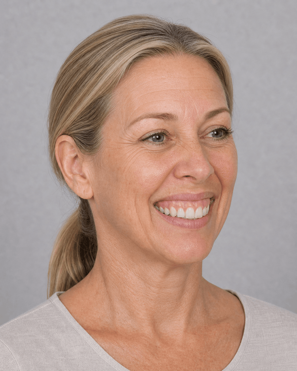 Lip and perioral consultation assessment for consultation planning at Core Aesthetics in Oakleigh