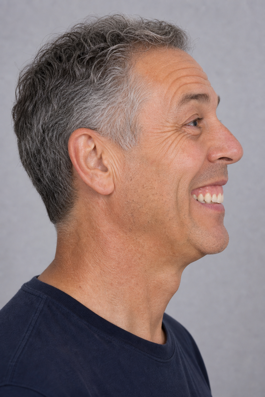 Lip and perioral consultation assessment for consultation planning at Core Aesthetics in Oakleigh