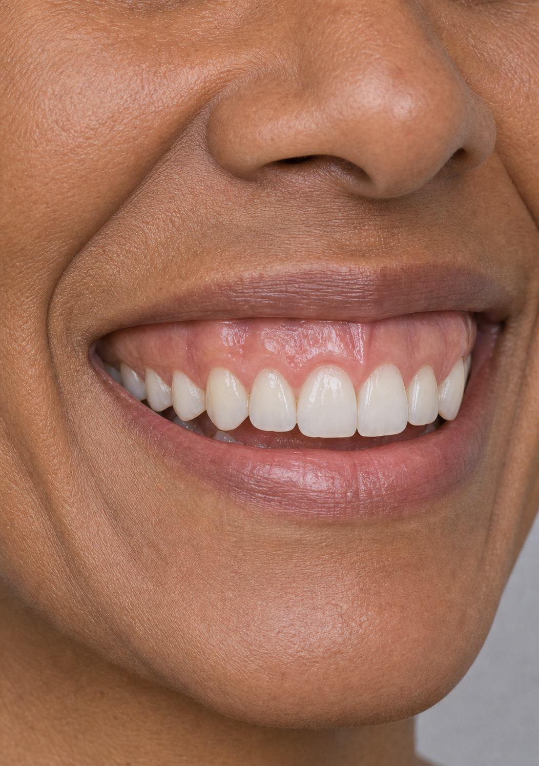 Lip and perioral consultation assessment for consultation planning at Core Aesthetics in Oakleigh