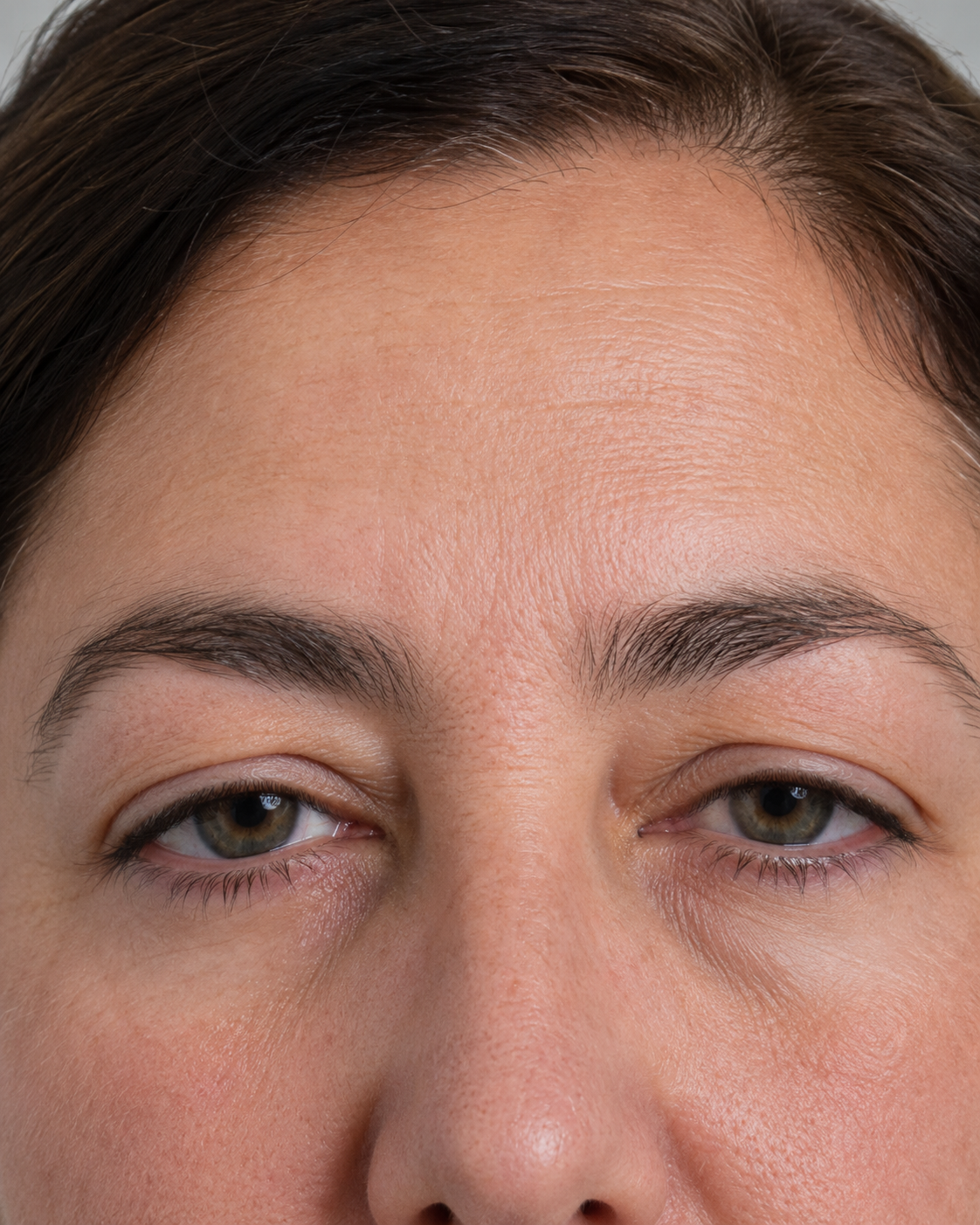 Lip and perioral consultation assessment for consultation planning at Core Aesthetics in Oakleigh