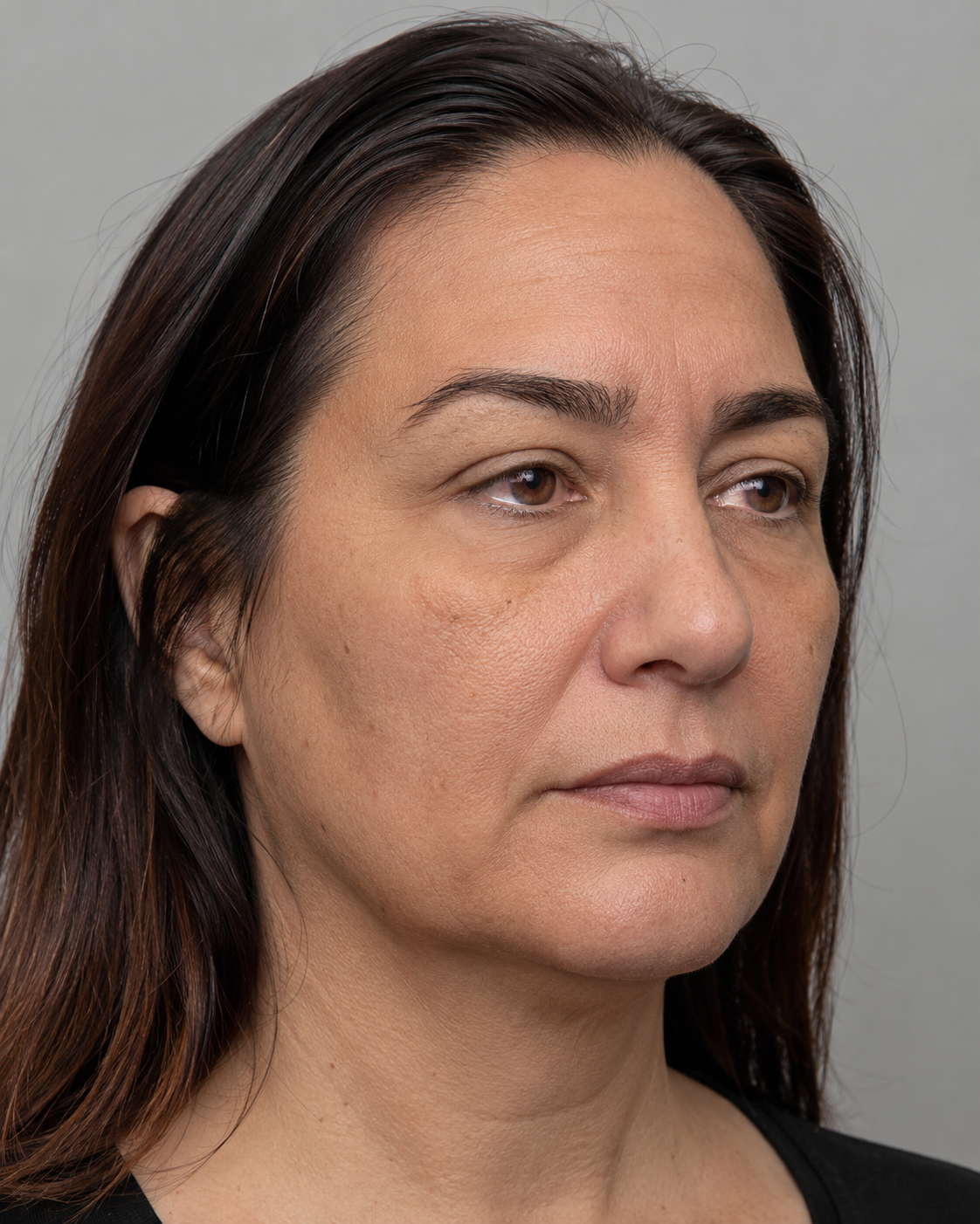 Facial structure consultation assessment for consultation planning at Core Aesthetics in Oakleigh