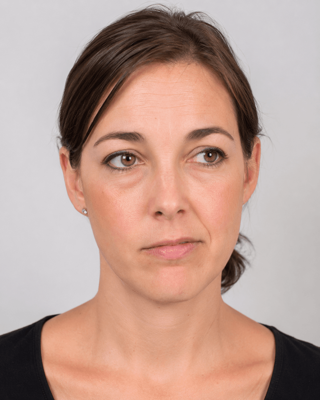 Aftercare and review consultation context for consultation planning at Core Aesthetics in Oakleigh