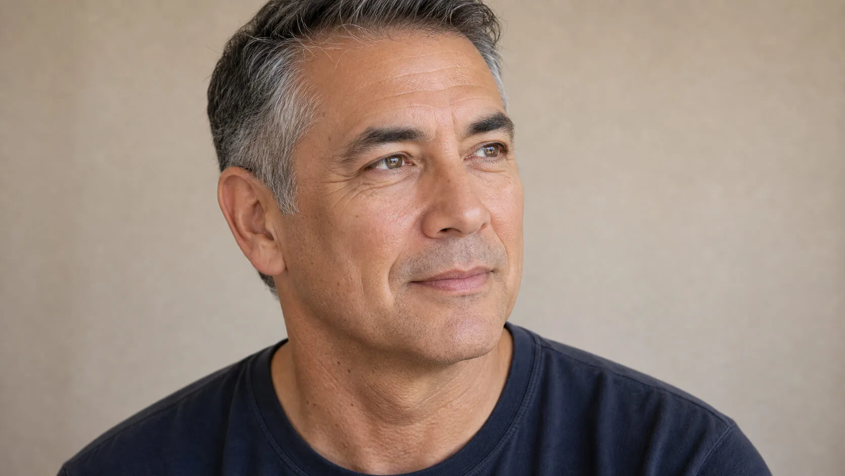 Adult man in a three-quarter facial view showing the natural cheek and midface contour