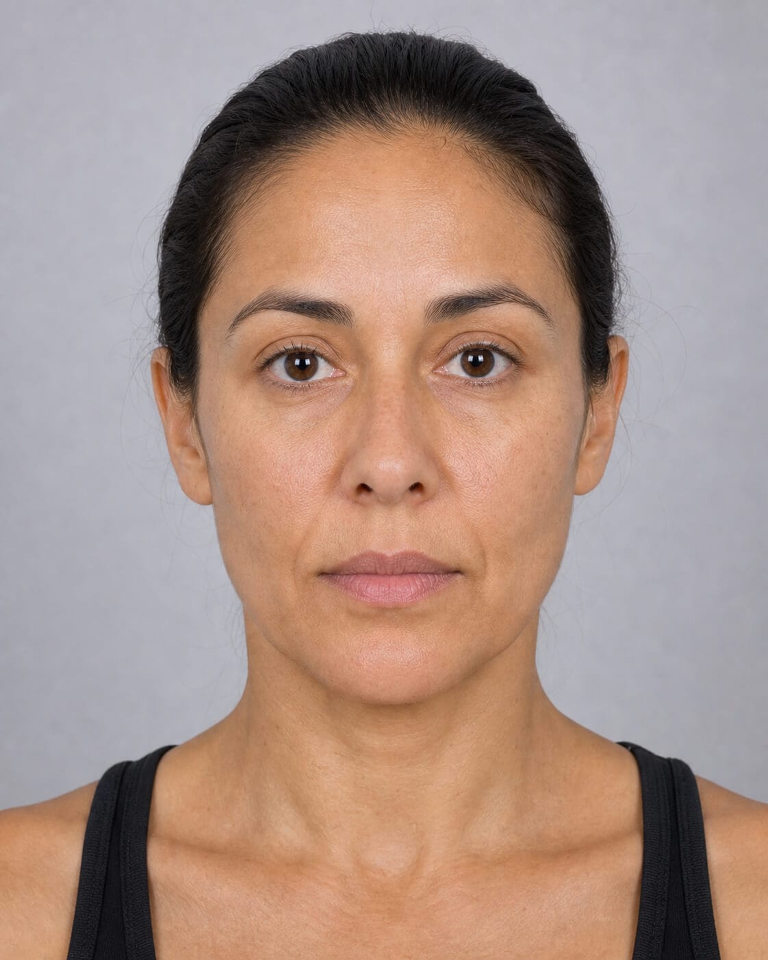 Adult woman shown from the front for a jaw muscle and lower face assessment discussion