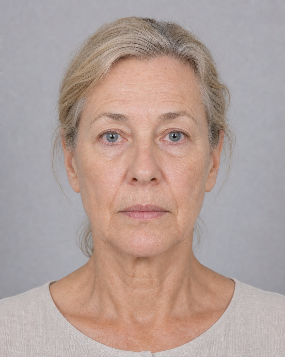 Chin and jawline consultation assessment for consultation planning at Core Aesthetics in Oakleigh
