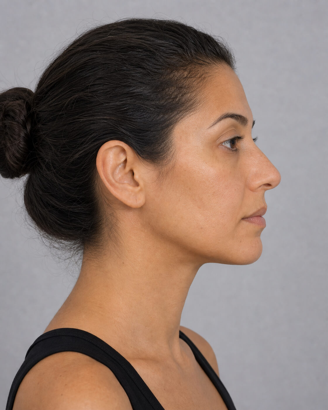 Side profile jawline assessment reference for jawline consultation at Core Aesthetics Oakleigh