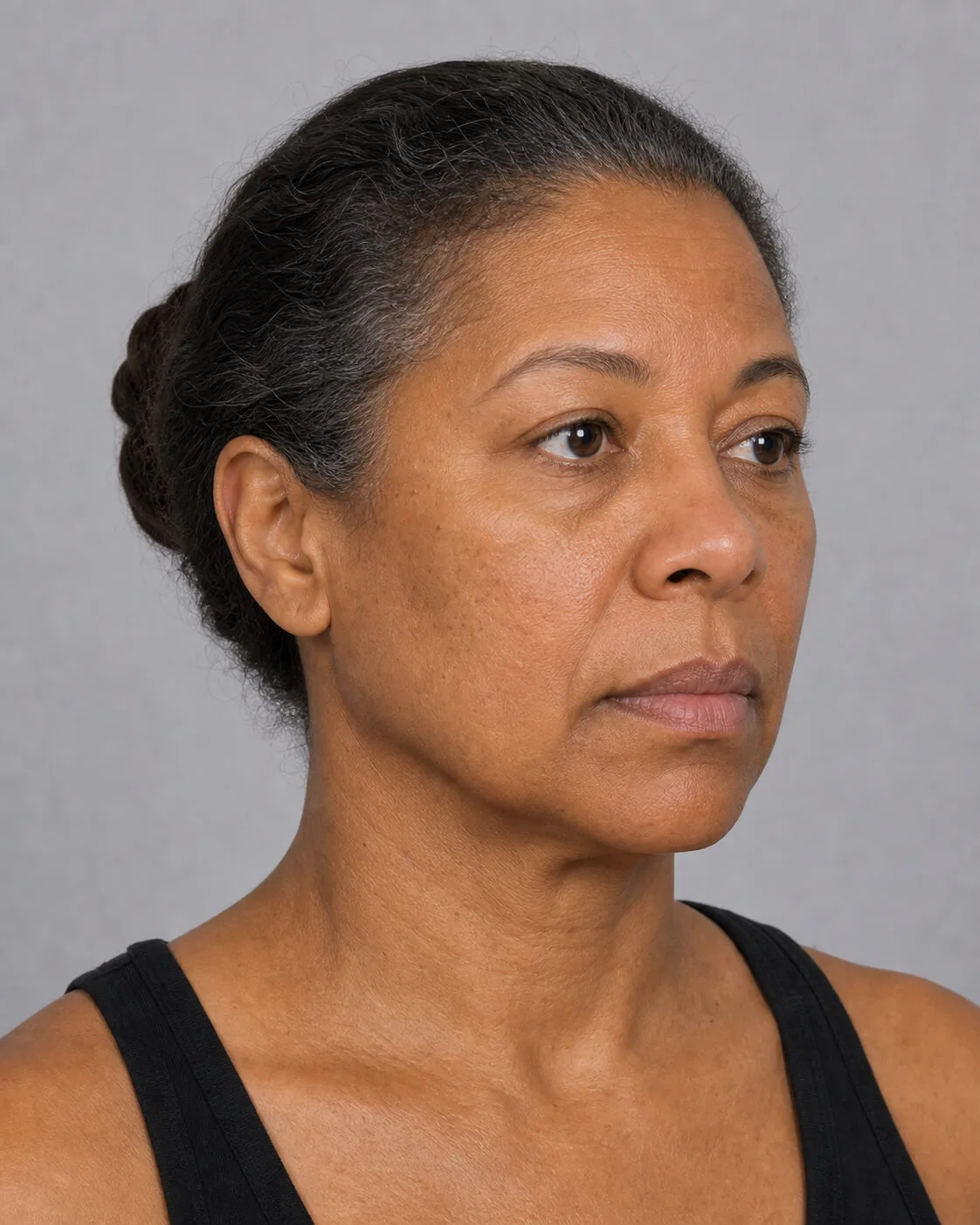 Chin and jawline consultation assessment for consultation planning at Core Aesthetics in Oakleigh