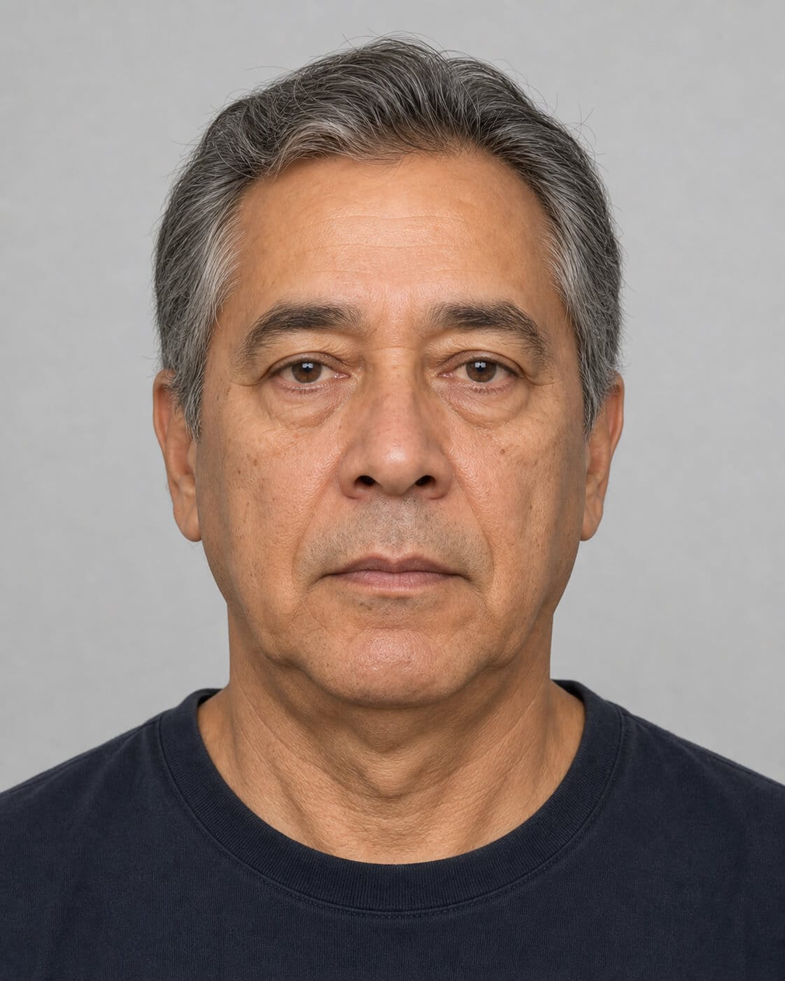 Adult patient shown in profile for a lower face consultation at Core Aesthetics in Oakleigh