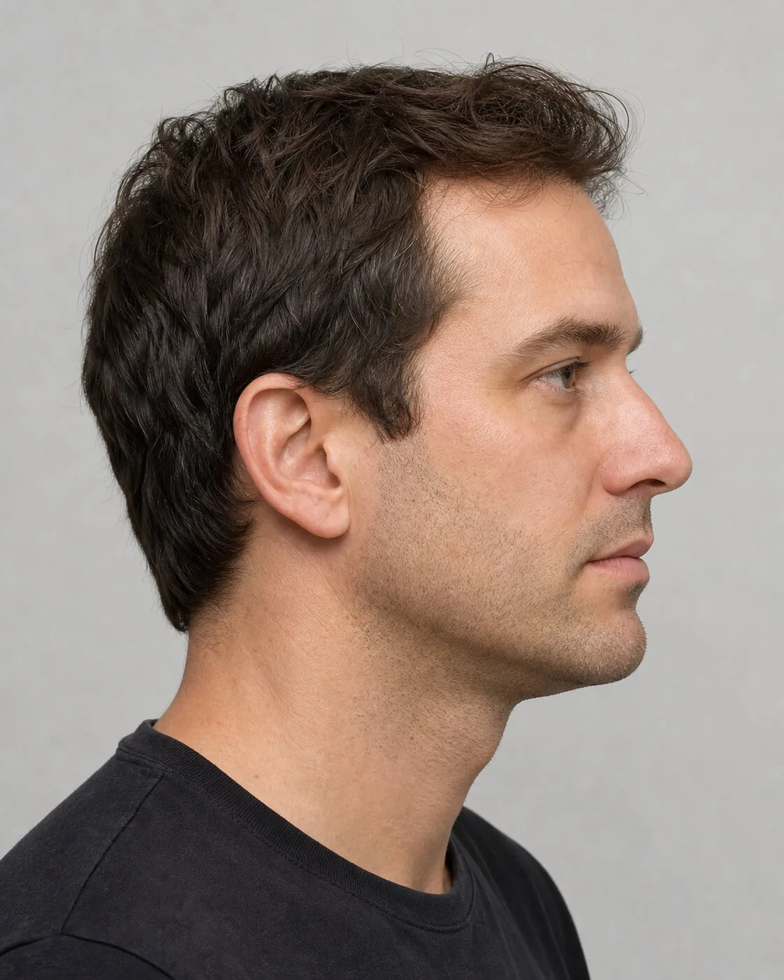 Chin and jawline consultation assessment for consultation planning at Core Aesthetics in Oakleigh