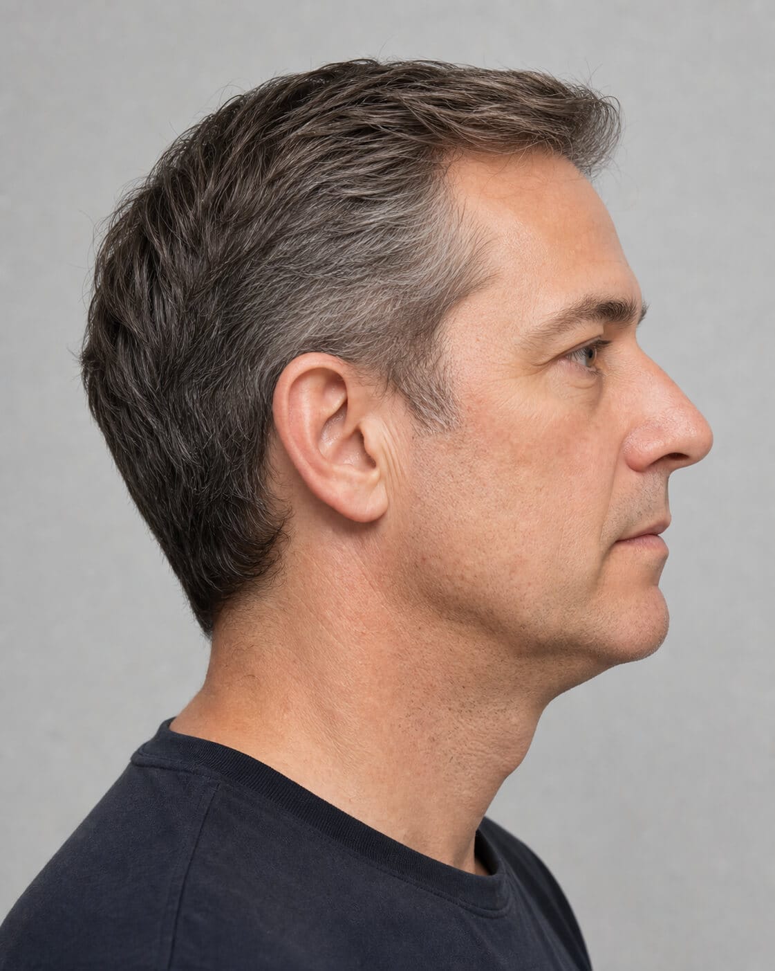 Side profile of an adult man showing chin projection and the jawline border