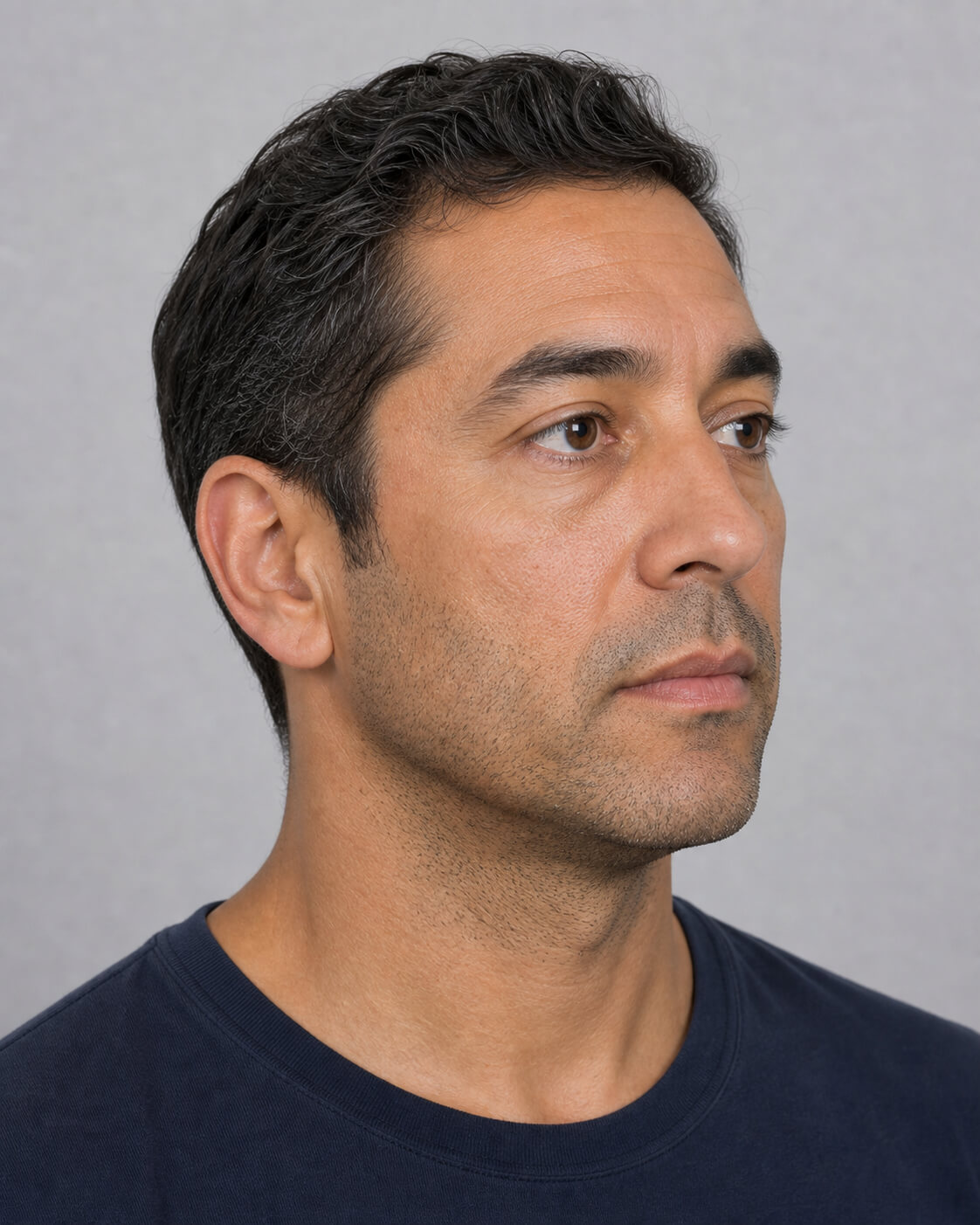 Chin and jawline consultation assessment for consultation planning at Core Aesthetics in Oakleigh