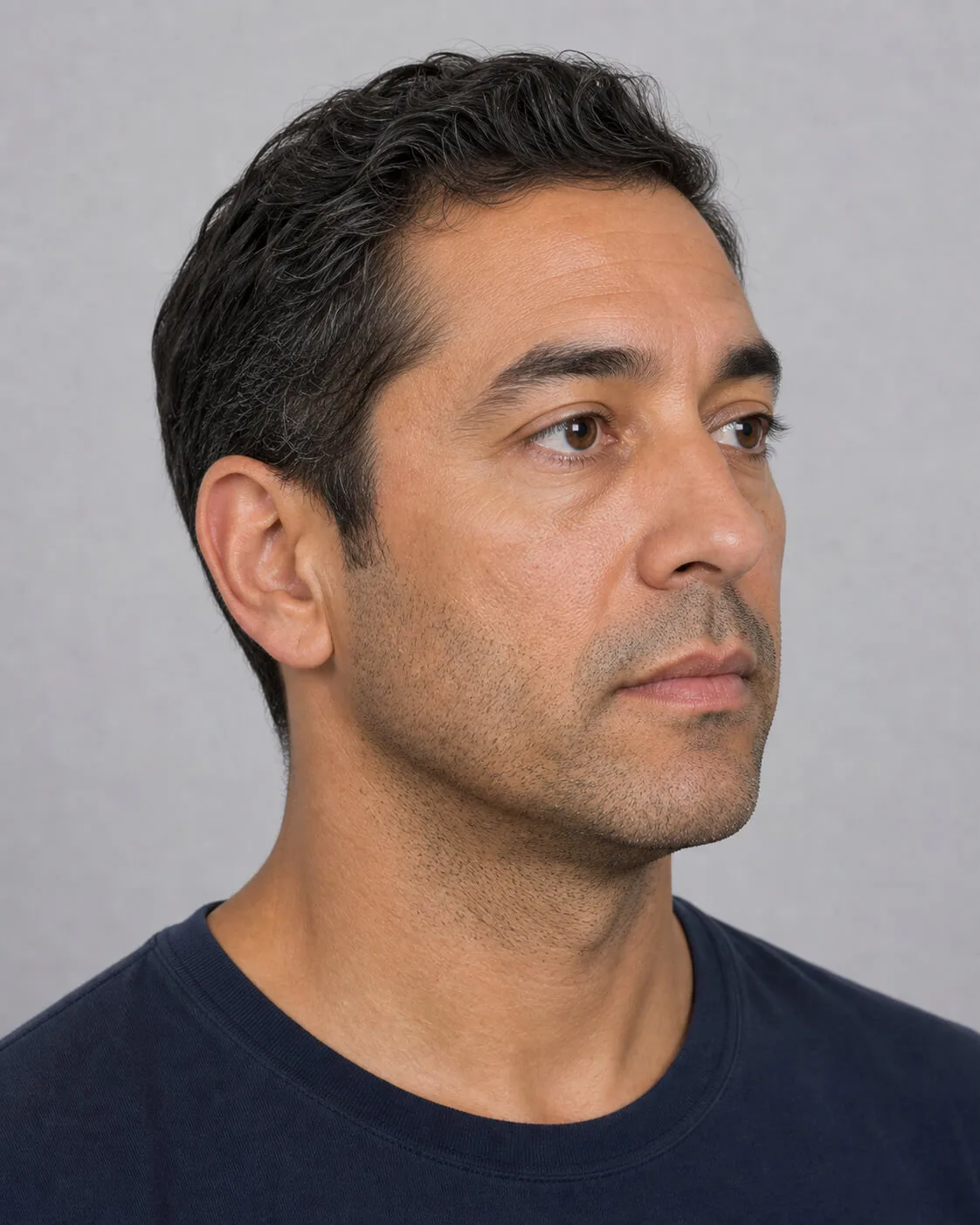 Three quarter portrait of an adult man used to compare chin support and jawline shape