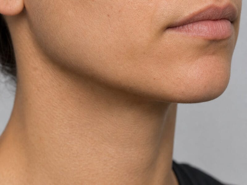 Chin, jaw border and lower face shown in a neutral three-quarter view