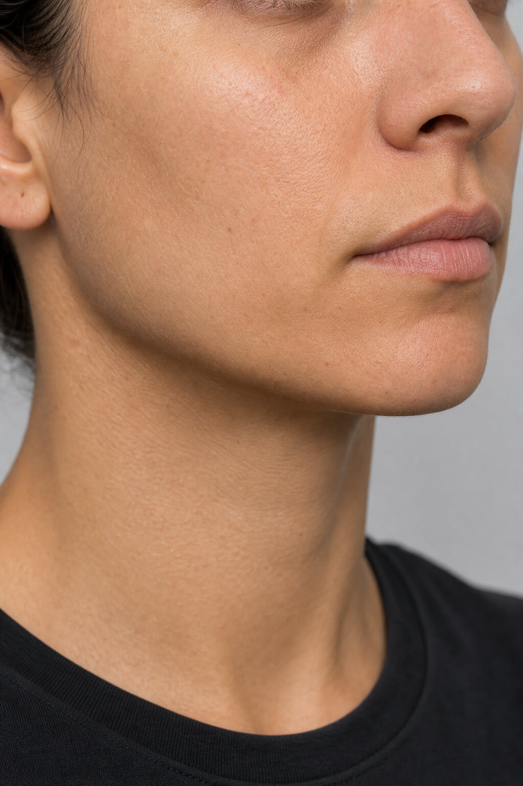 Chin and jawline consultation assessment for consultation planning at Core Aesthetics in Oakleigh