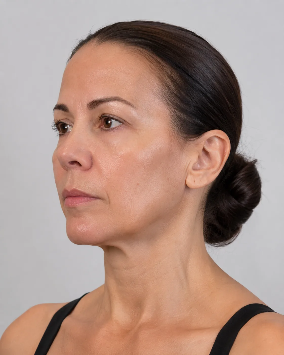 Adult patient shown from a three-quarter view during a jawline and neck transition assessment
