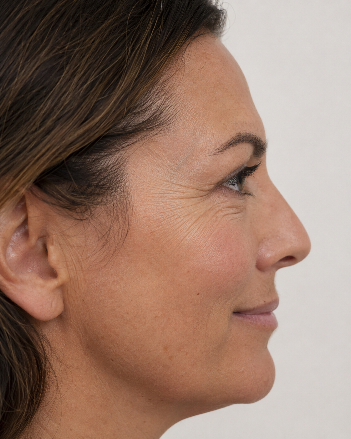 Facial structure consultation assessment for consultation planning at Core Aesthetics in Oakleigh