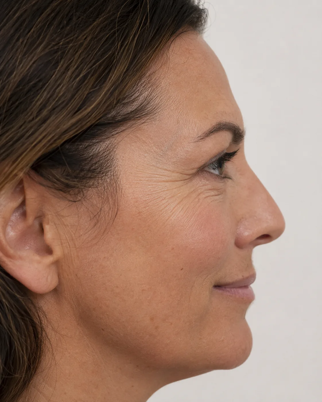 Side profile facial assessment reference for structure and movement review at Core Aesthetics