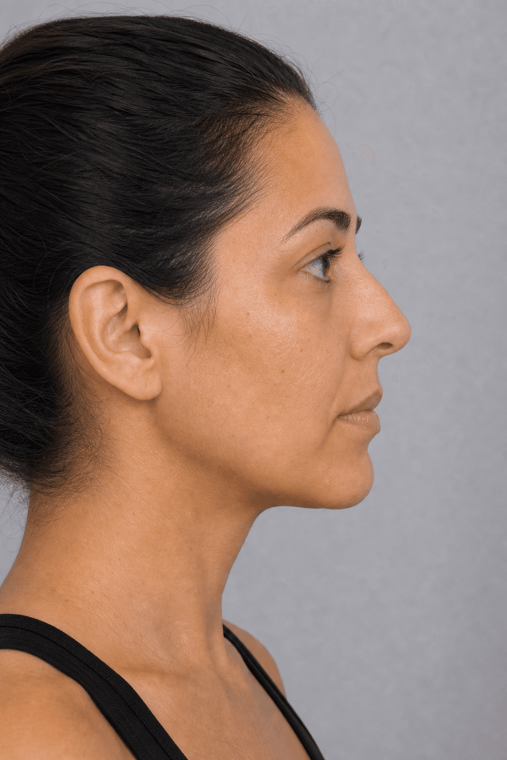 Adult woman in side profile for a lip comfort discussion