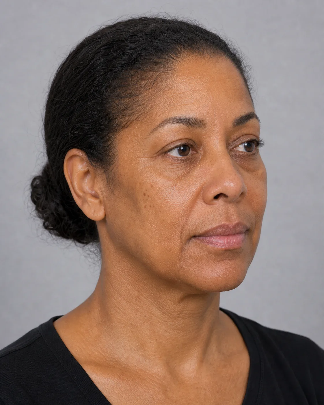 Adult woman in a three quarter view used to support a lip comfort and settling discussion