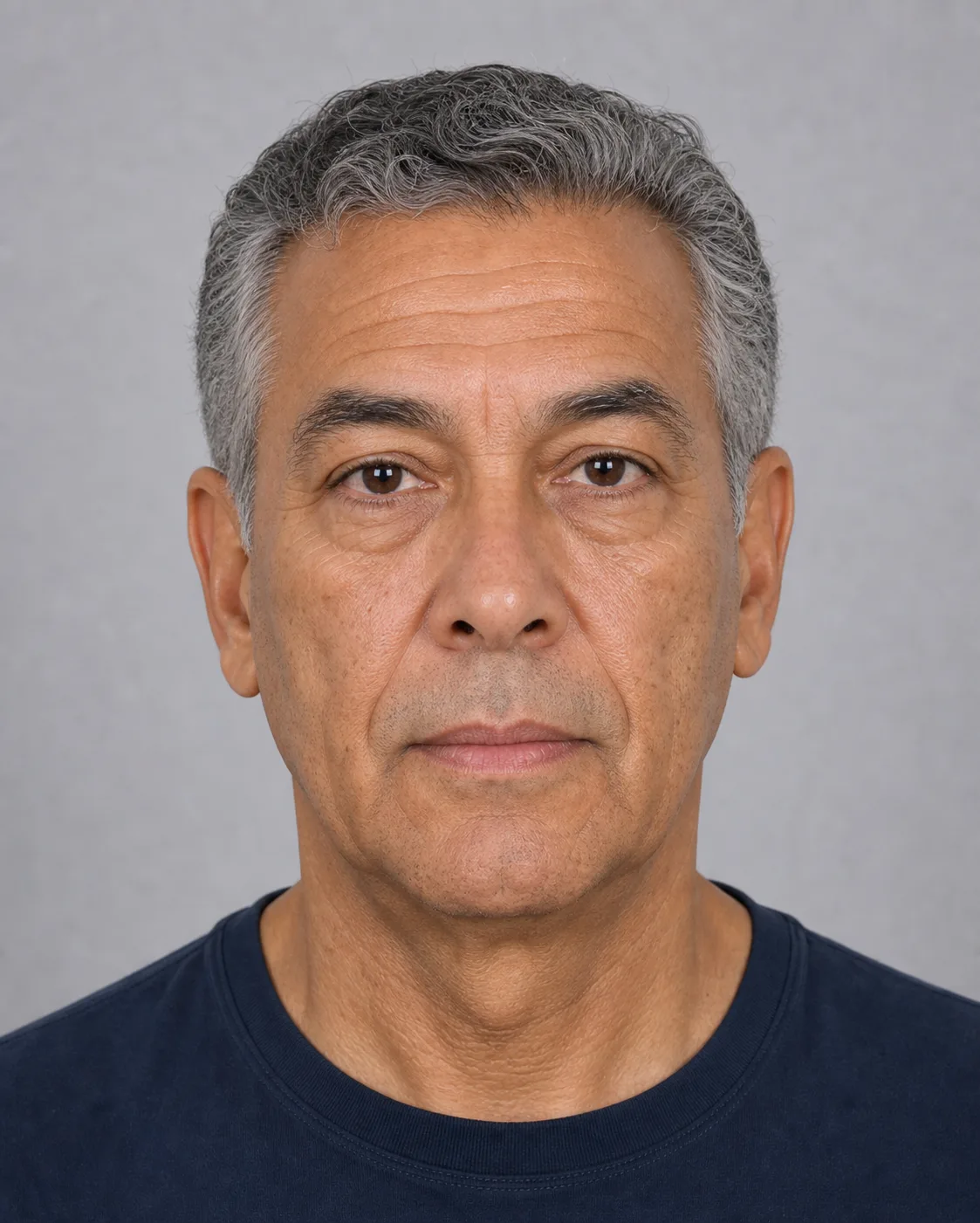 Illustrative level front portrait used to map facial volume, symmetry, tooth show and lower face support without diagnosing a cause