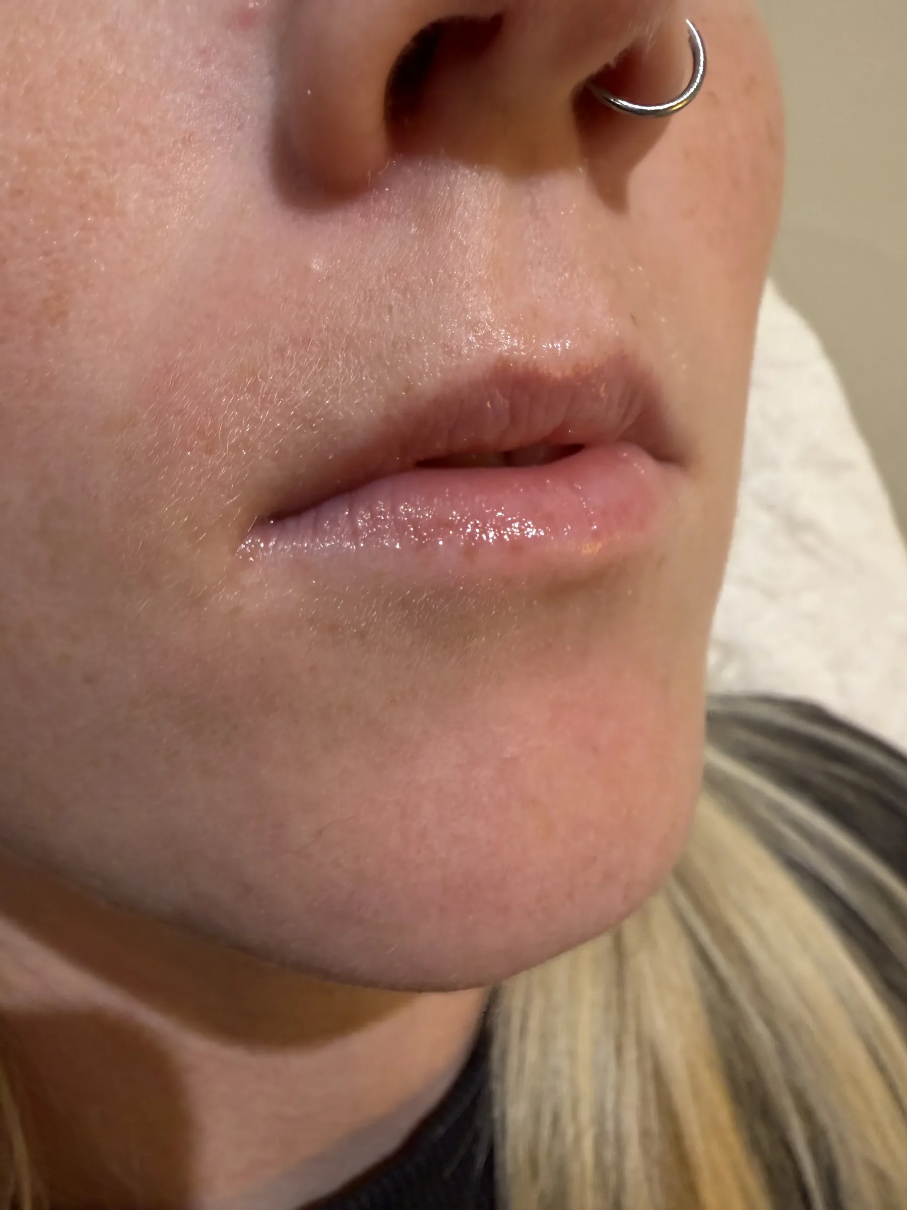 Adult female staff model speaking to show ordinary lip movement during consultation planning