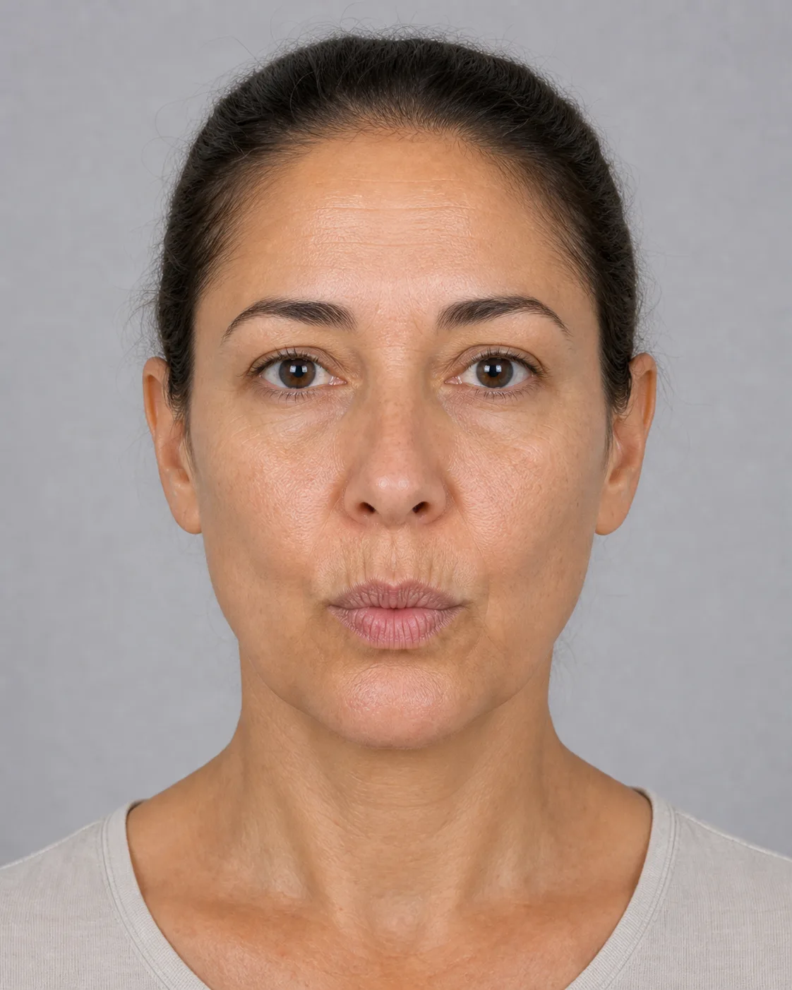 Adult lip line seen from the front while separating gummy smile movement from dental questions