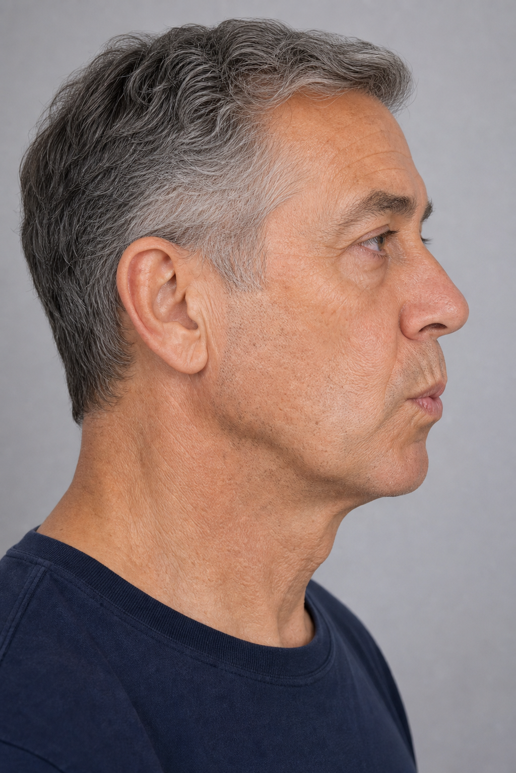 Lip and perioral consultation assessment for consultation planning at Core Aesthetics in Oakleigh