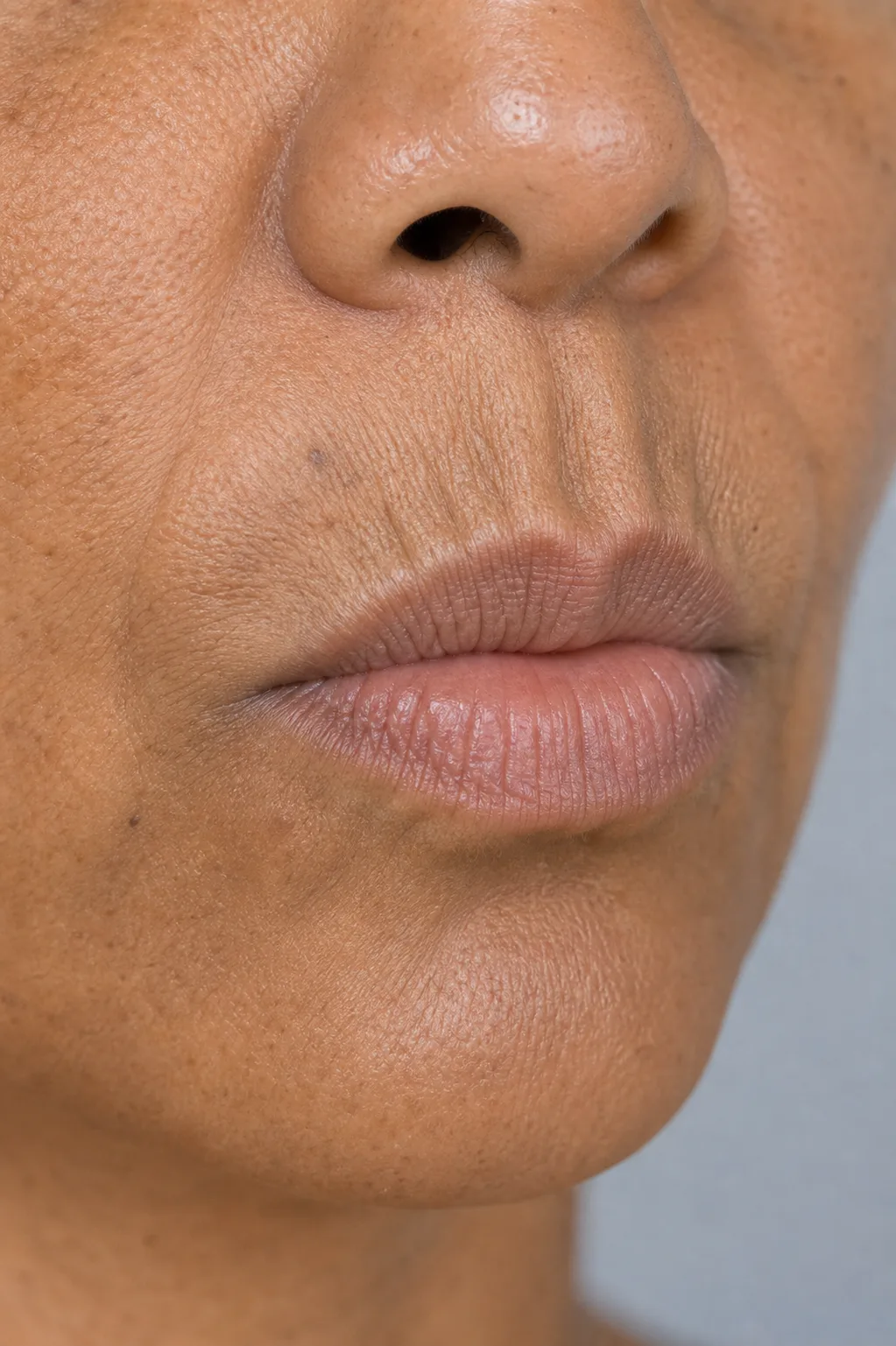 Close educational view of an adult woman showing upper lip vermilion, philtral columns and natural lines in the skin above the mouth