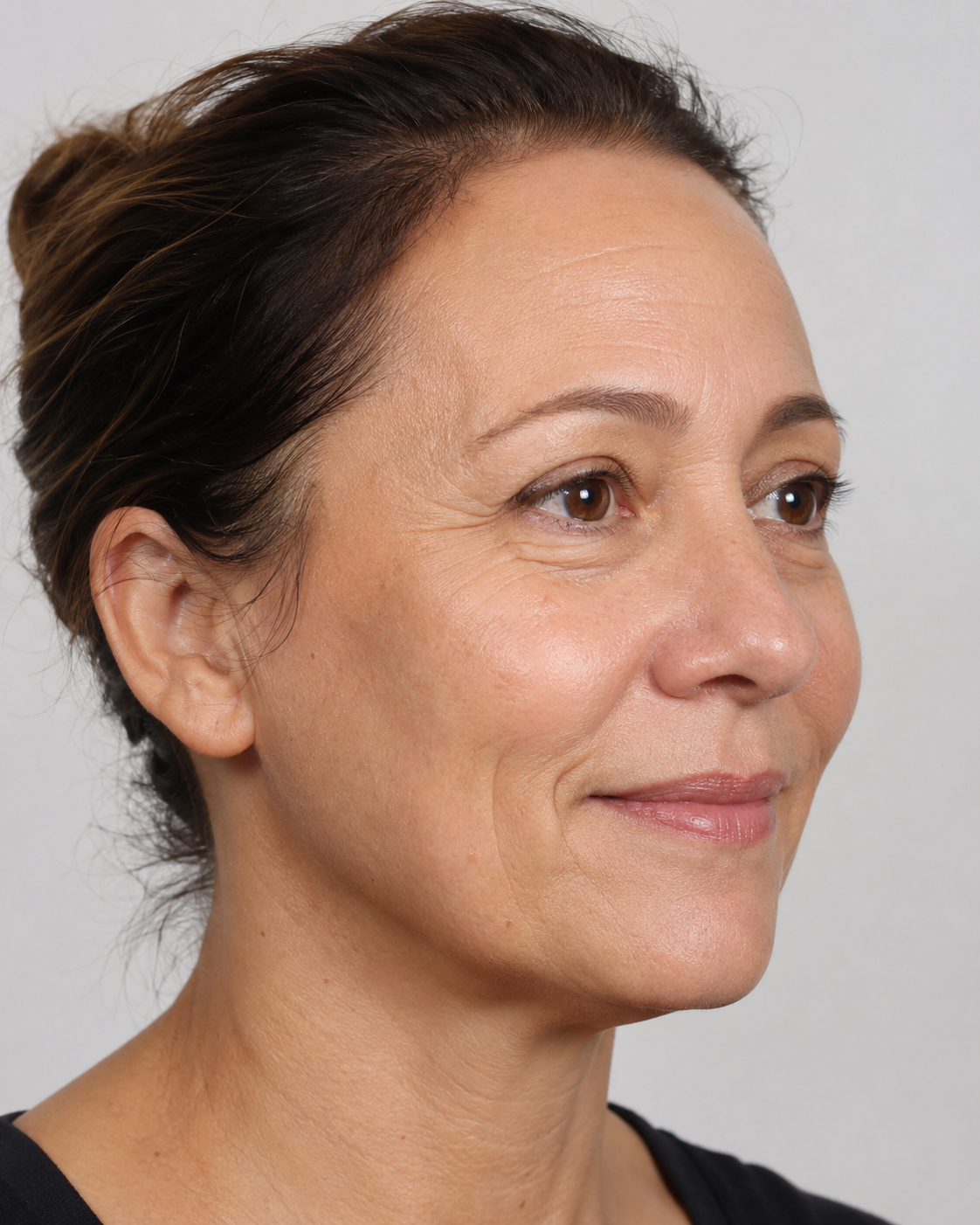 Wrinkle and upper-face consultation assessment for consultation planning at Core Aesthetics in Oakleigh