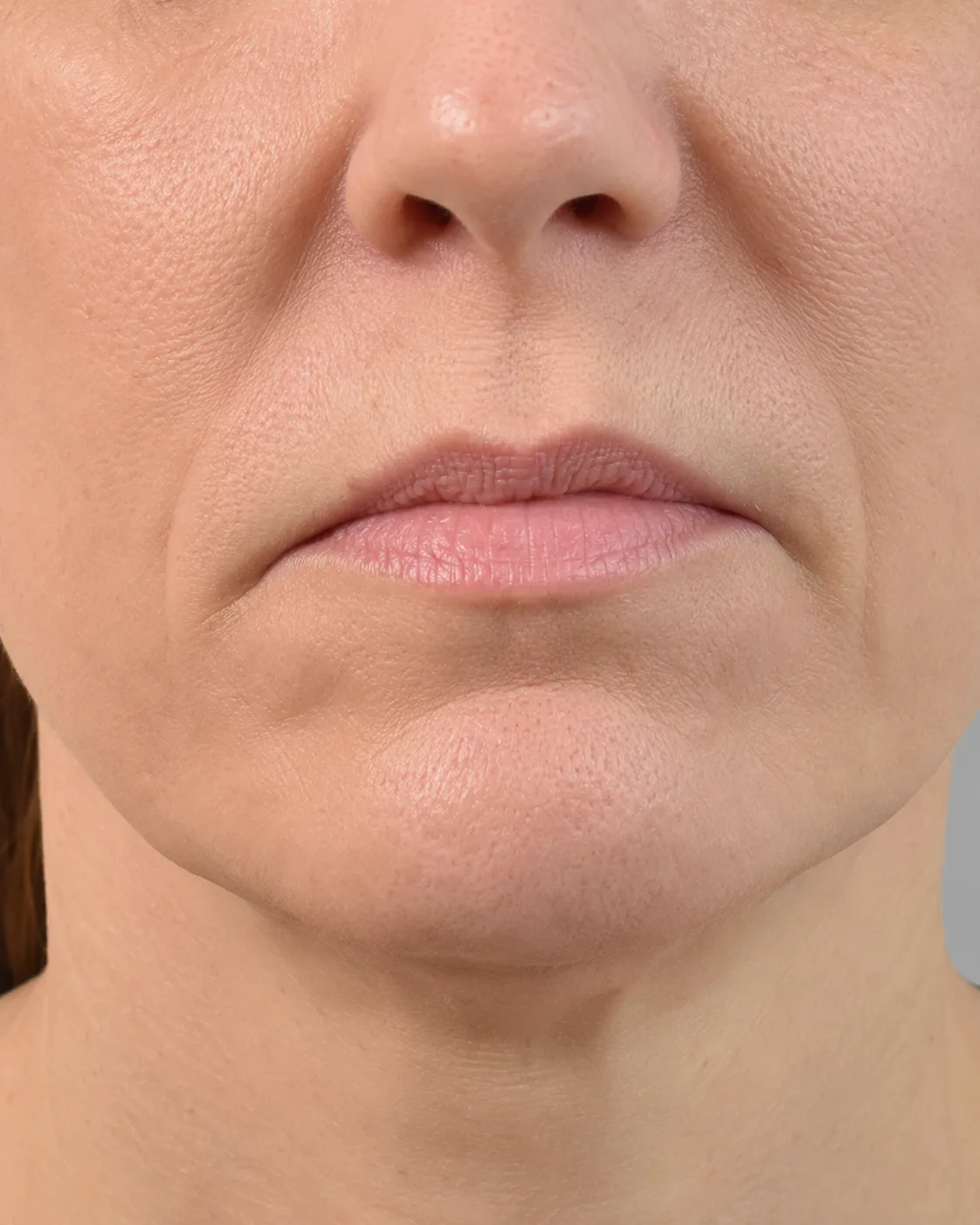 Elwood lip volume close view used to observe relaxed posture and lower lip movement
