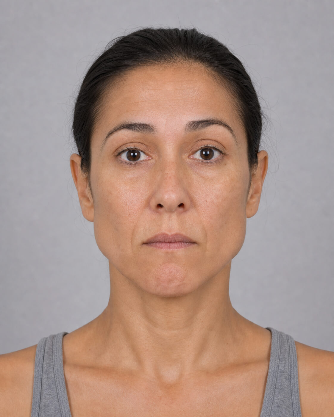 Chin and jawline consultation assessment for consultation planning at Core Aesthetics in Oakleigh
