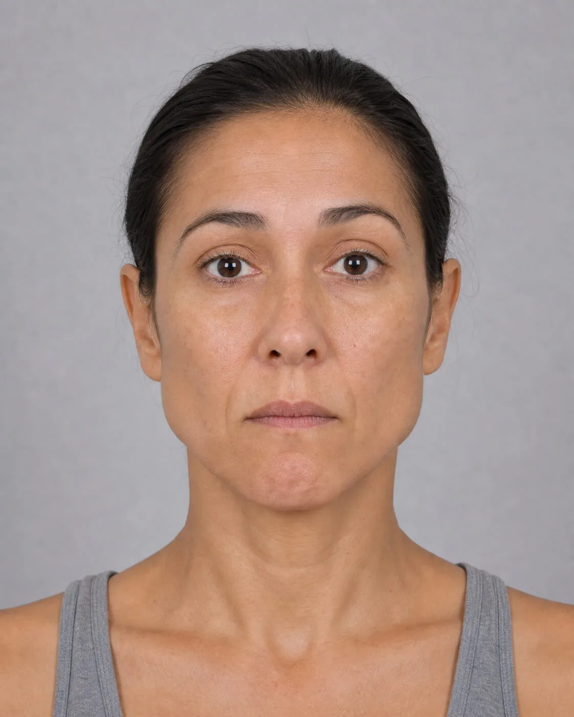 Female front lower face view showing jaw muscle area for longer term comparison