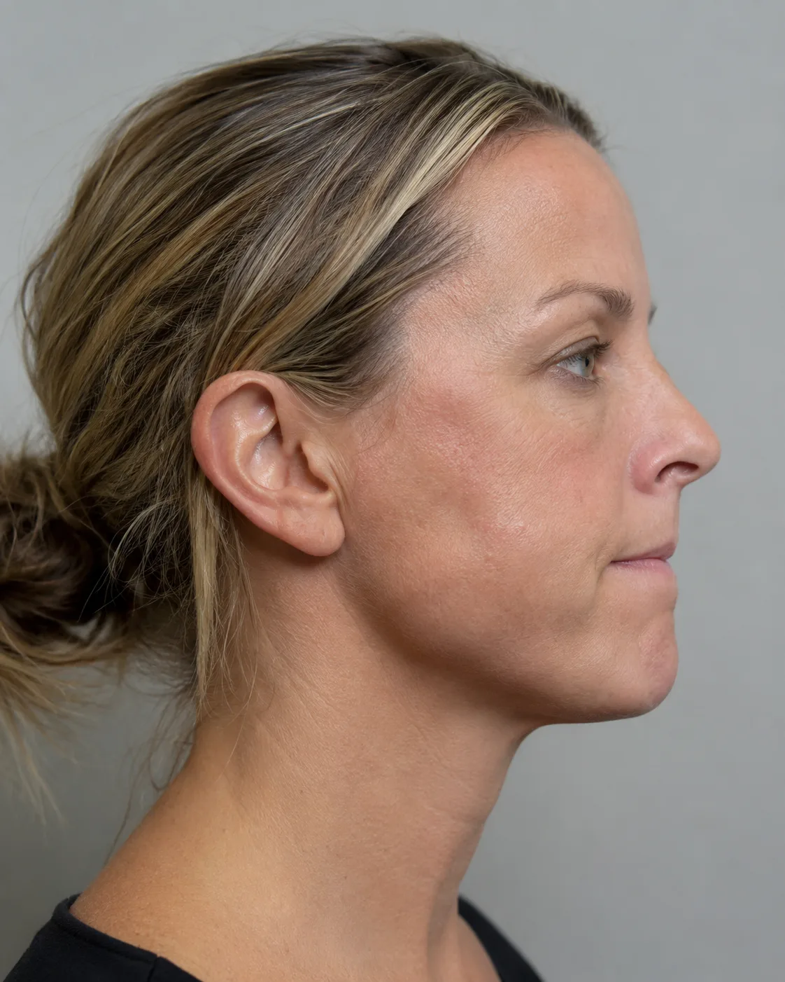 Adult patient speaking privately with a practitioner about a cosmetic decision