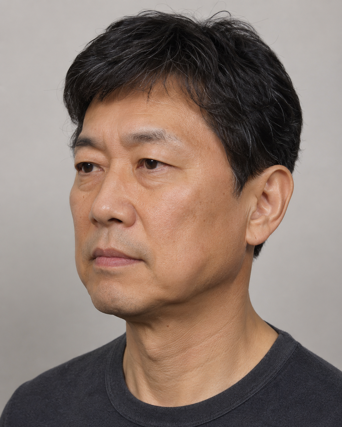 Wrinkle and upper-face consultation assessment for consultation planning at Core Aesthetics in Oakleigh