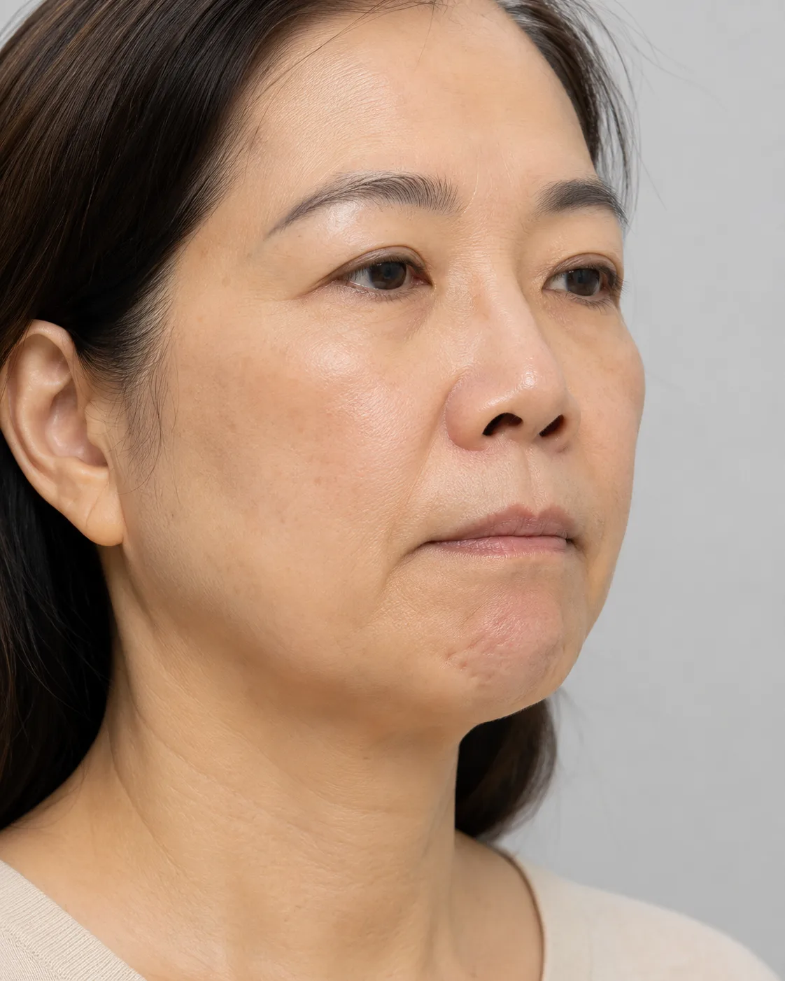 Three-quarter chin assessment image shown for general information at Core Aesthetics