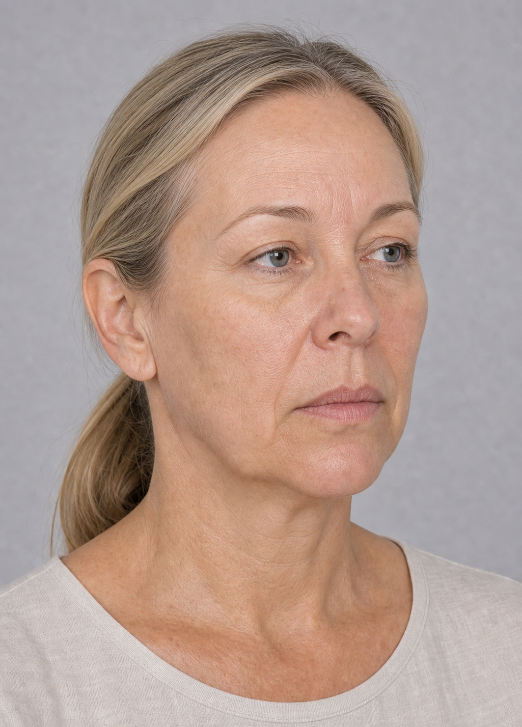 Lip and perioral consultation assessment for consultation planning at Core Aesthetics in Oakleigh