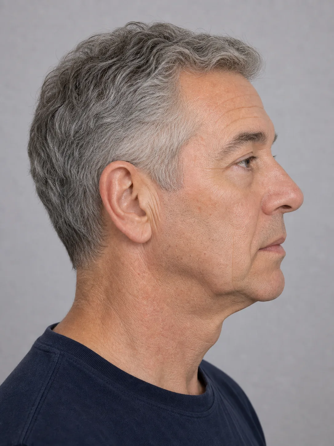 Male mouth corner and perioral assessment context at Core Aesthetics
