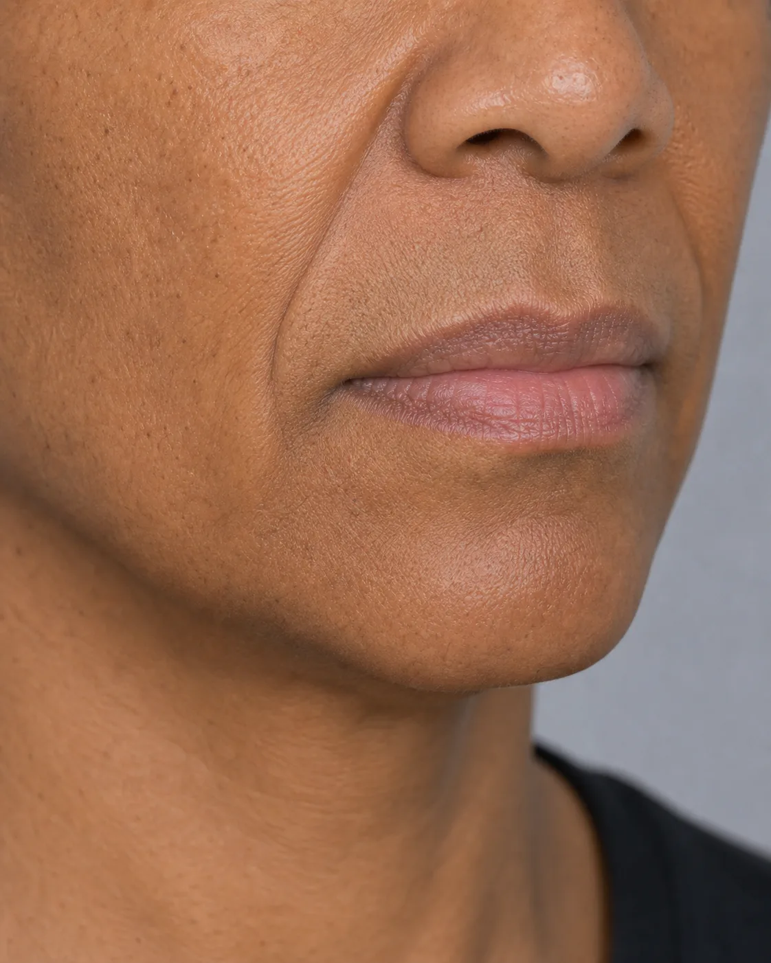Close three quarter view of an adult woman showing the mouth corner, lower face fold and nearby jaw contour
