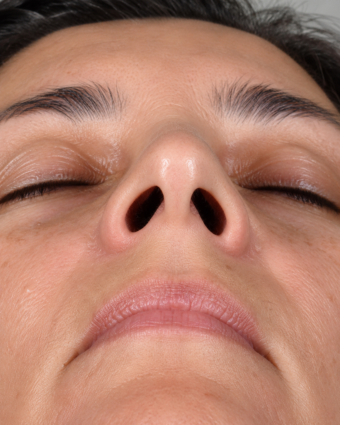 Facial structure consultation assessment for consultation planning at Core Aesthetics in Oakleigh