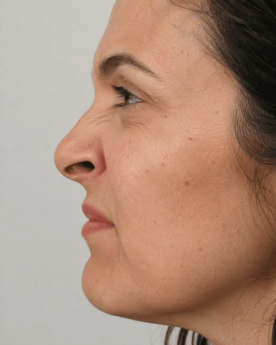 Safety and suitability consultation context for consultation planning at Core Aesthetics in Oakleigh