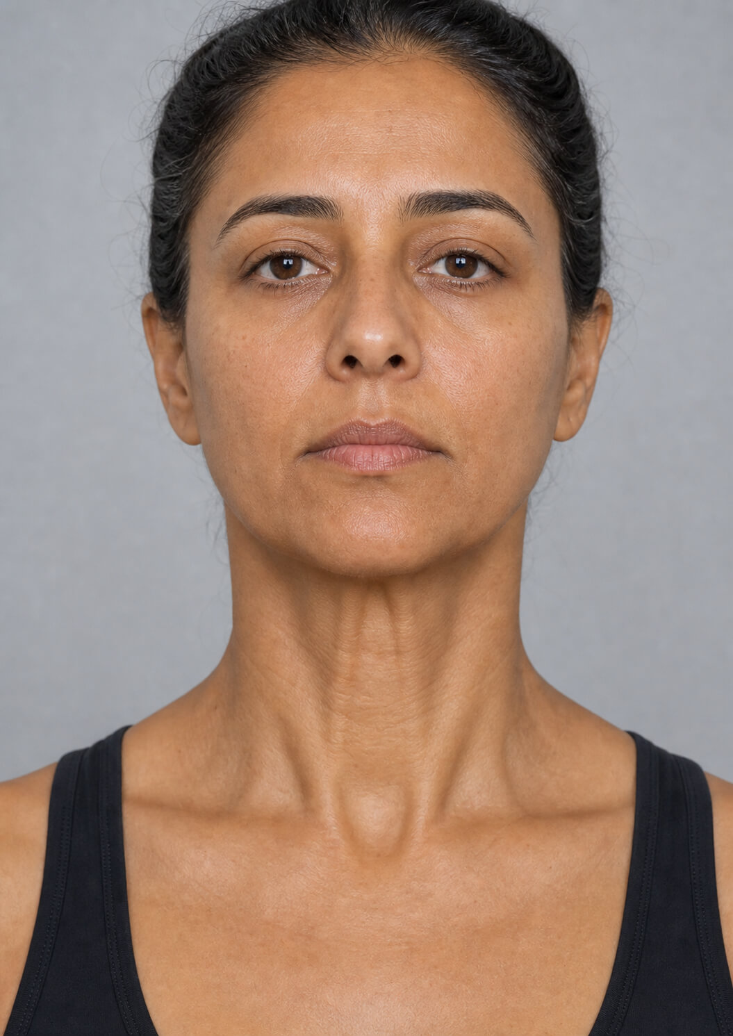 Chin and jawline consultation assessment for consultation planning at Core Aesthetics in Oakleigh