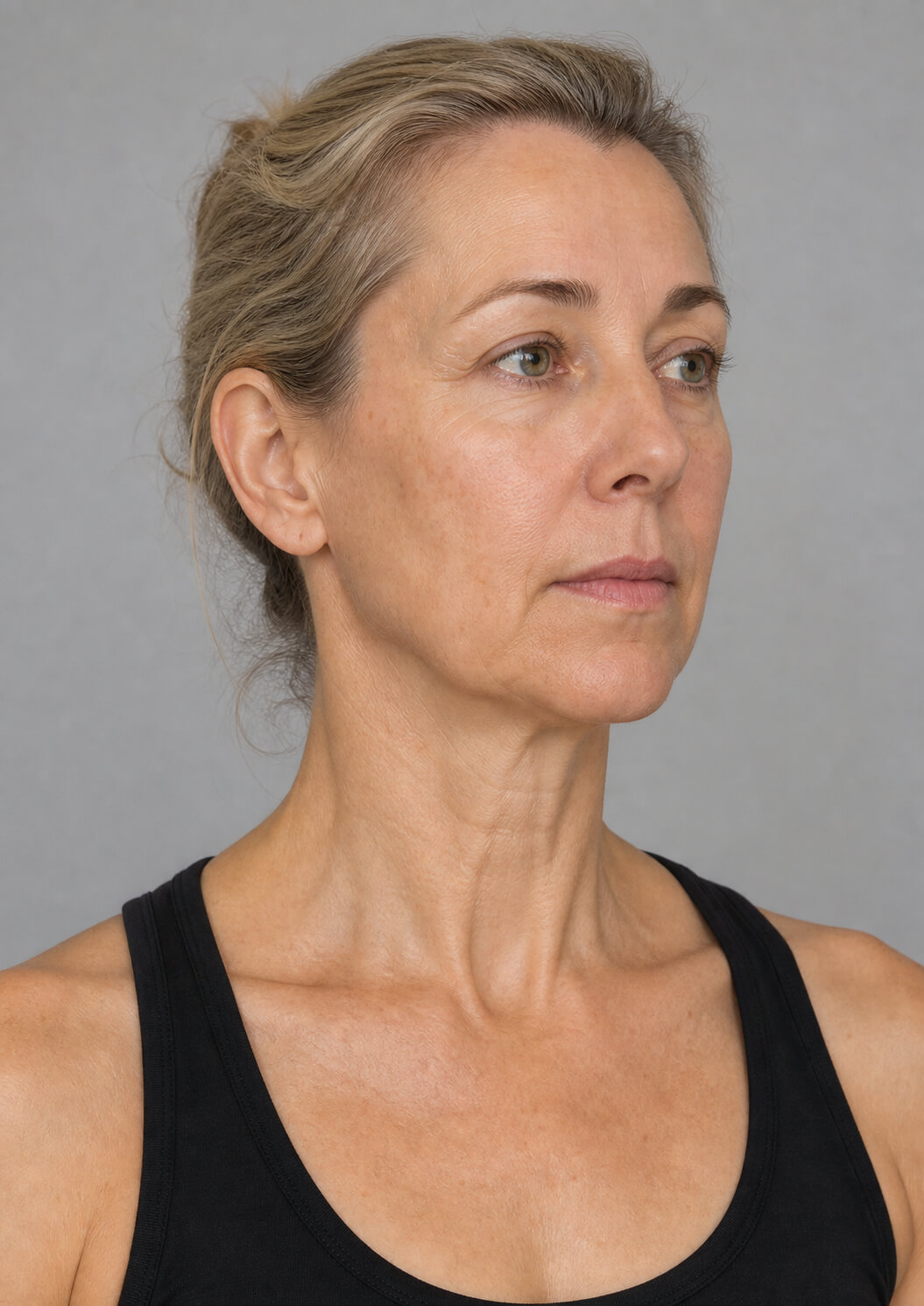 Chin and jawline consultation assessment for consultation planning at Core Aesthetics in Oakleigh
