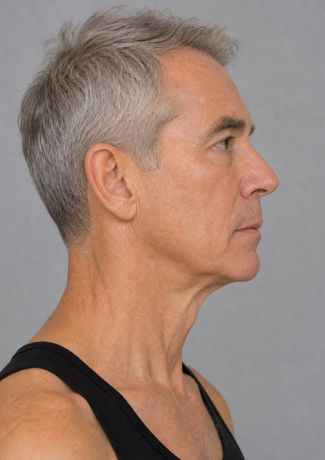 Chin and jawline consultation assessment for consultation planning at Core Aesthetics in Oakleigh