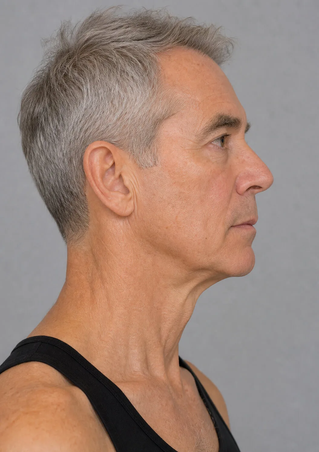 Chin and jawline consultation assessment for consultation planning at Core Aesthetics in Oakleigh