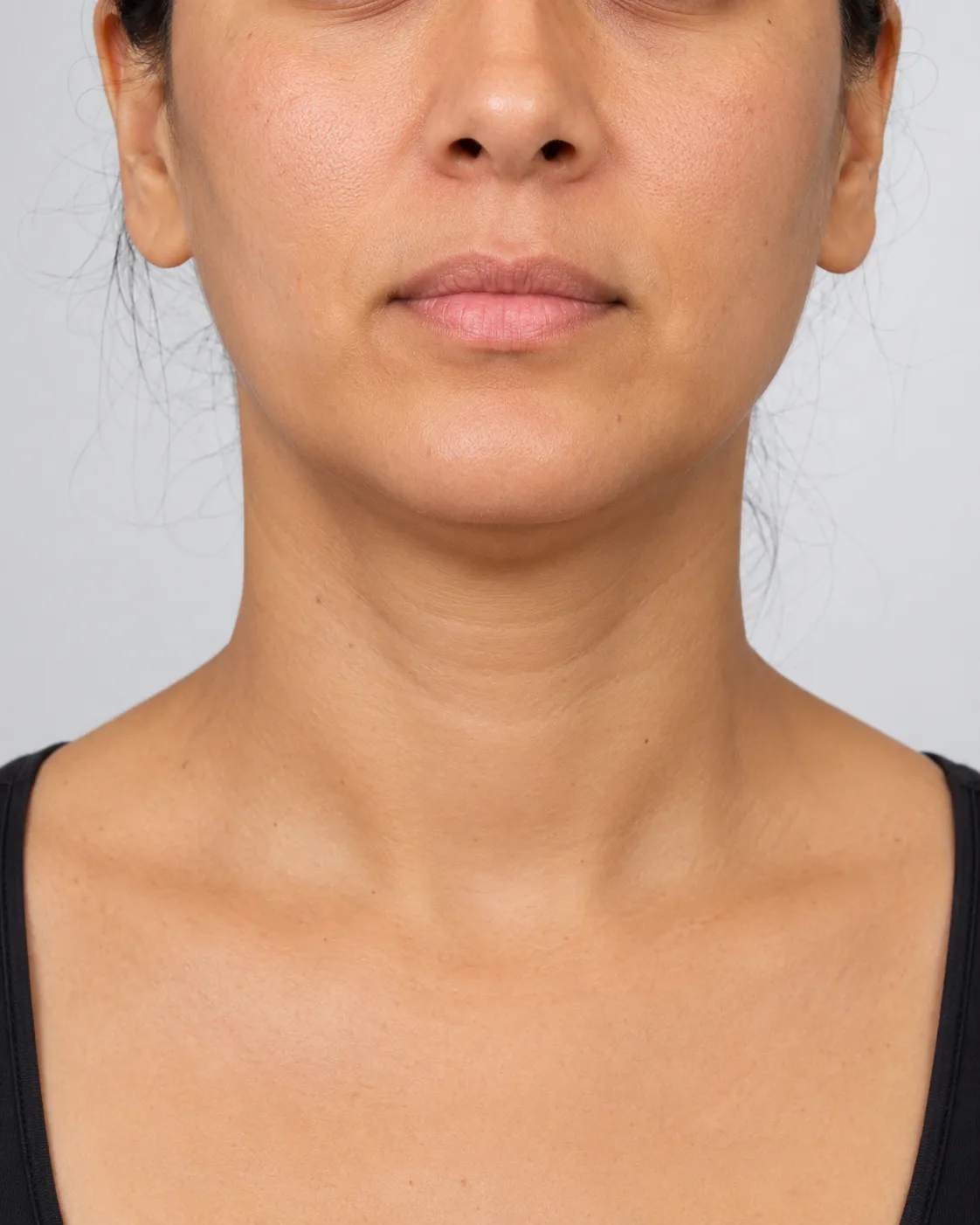Adult patient in a consultation about jawline care, everyday pressure and review planning